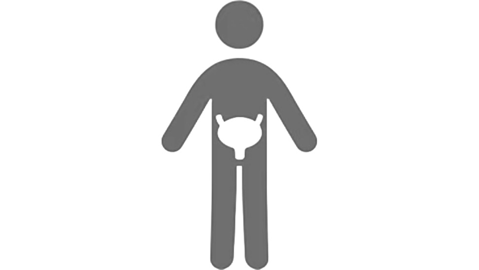 <h2><span style="font-size:30px"><strong>Varför mäta urinvolym?</strong></span></h2>