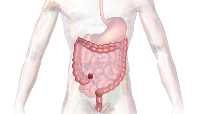 Ileostomi anatomi