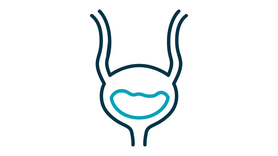 <h2><span style="font-size:30px"><strong>Problem med urinblåsan</strong></span></h2>



